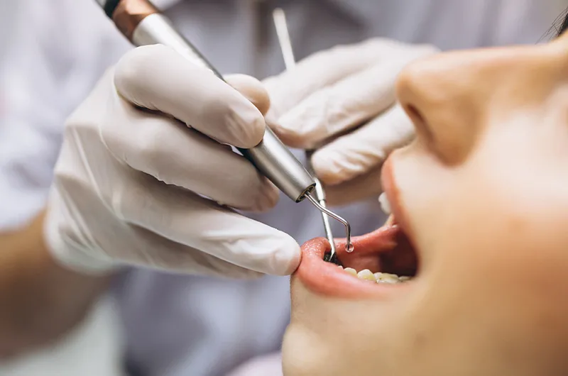Dental Implant Treatment in Oran